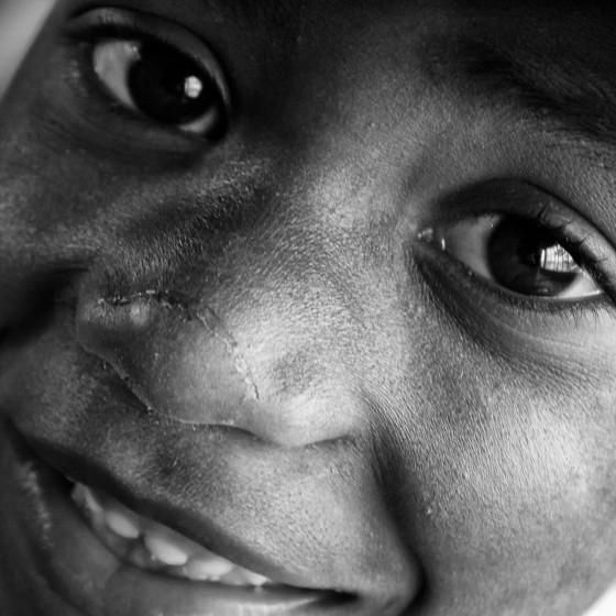 Fotografía niños en la pobreza
